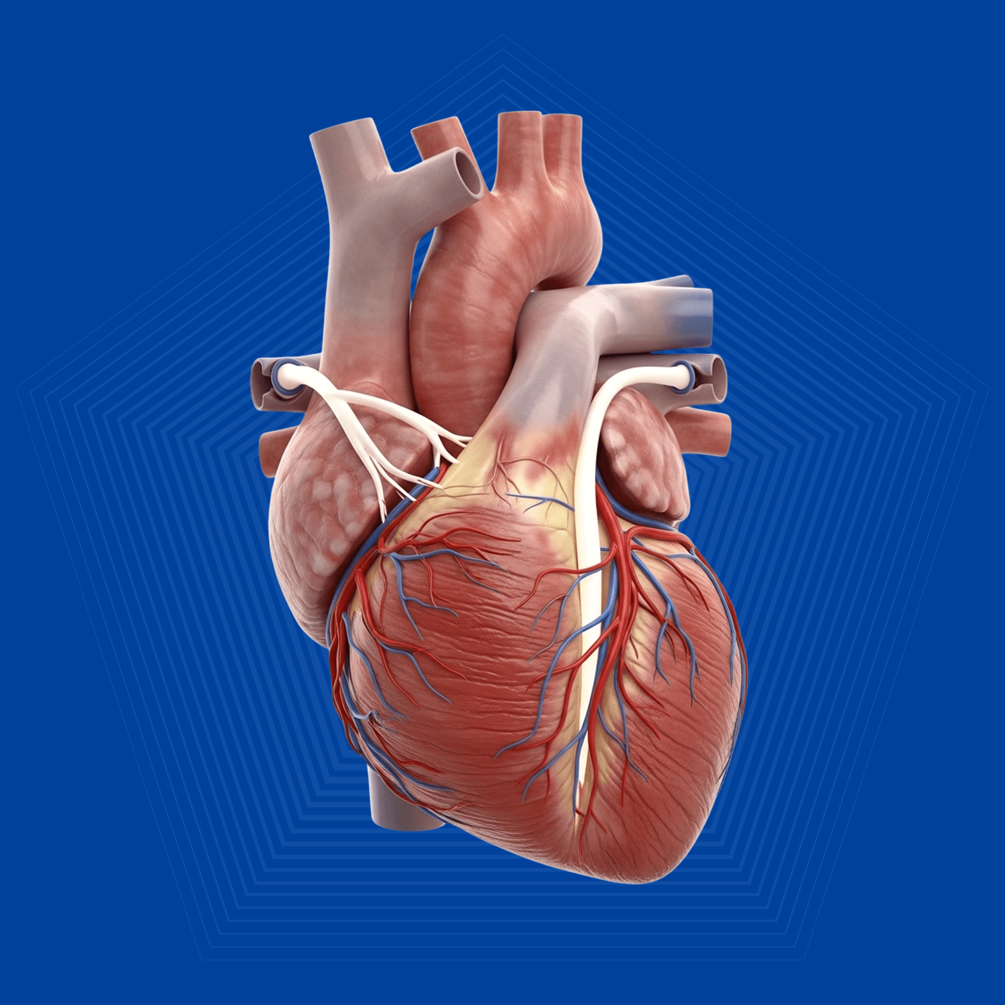 Heart Bypass Surgery