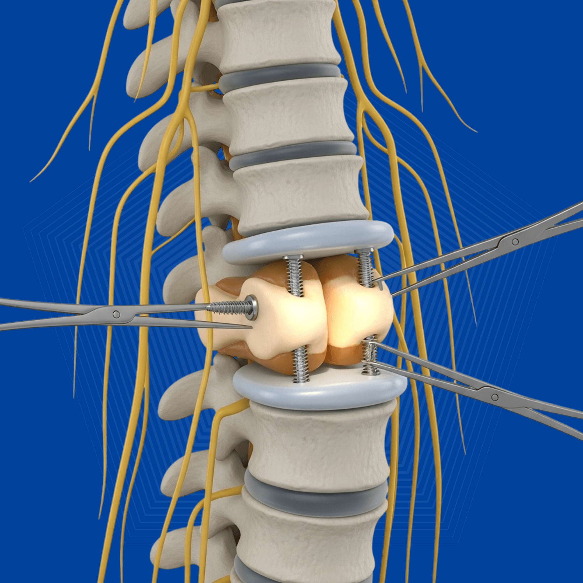 Rehabilitation Programs
