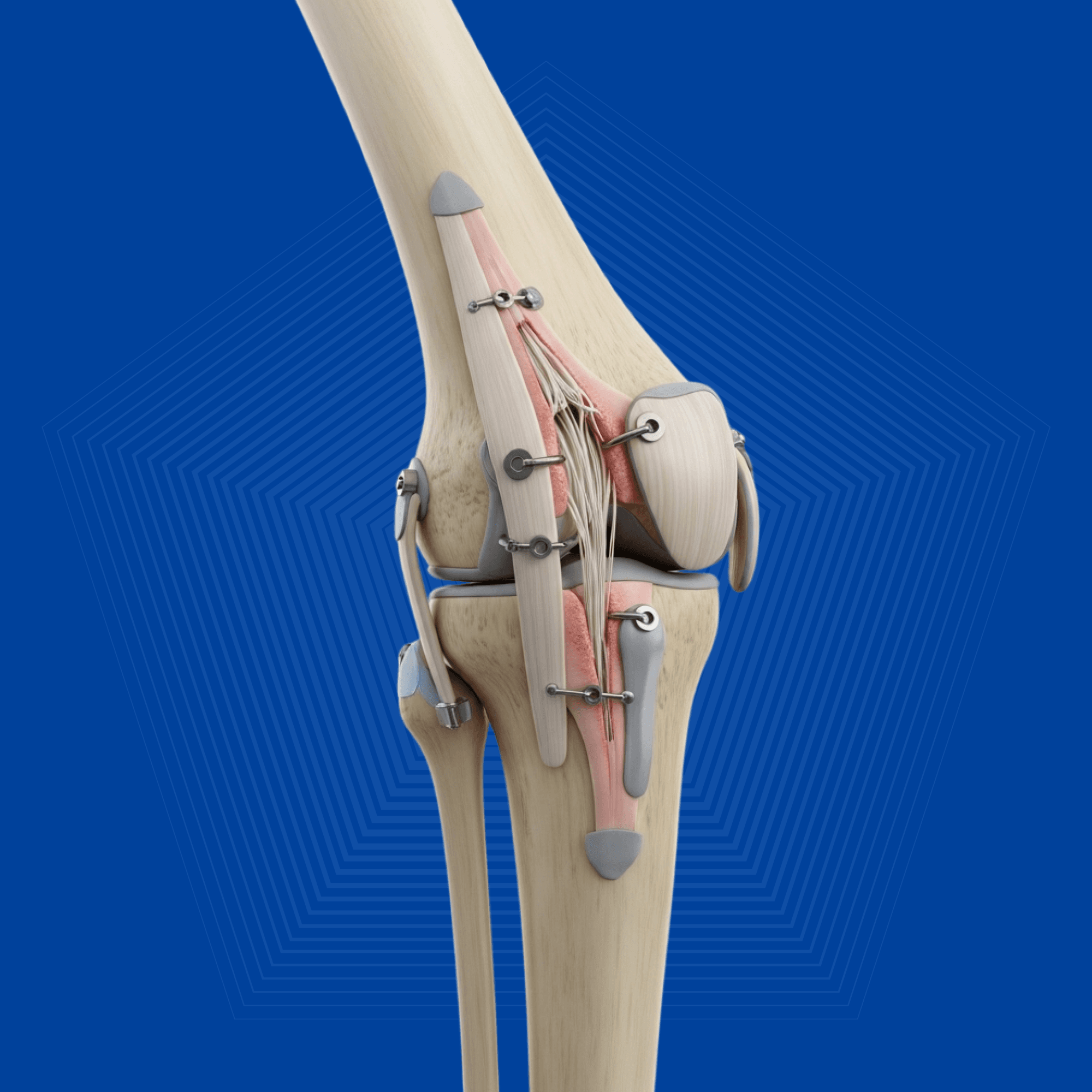 Chronic Pain Management